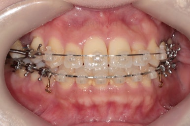 부산연산동치과