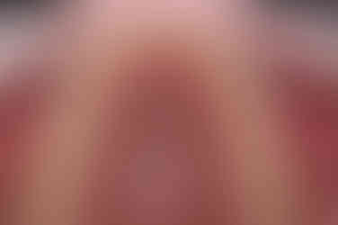 부산앞니부분교정