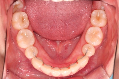 부산교정전문의