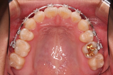 연산동치아교정치과