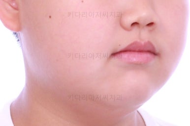 부산교정치과추천