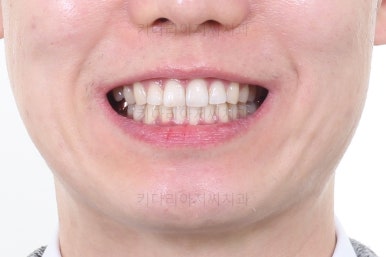 부산교정치과
