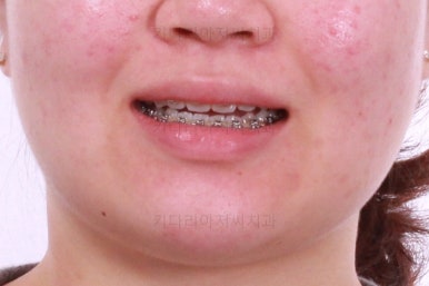 부산치아교정치과