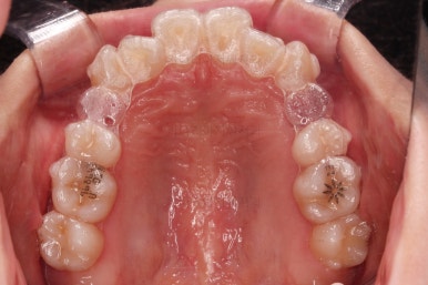 부산교정전문의