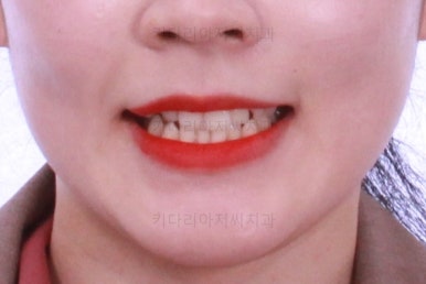 부산교정