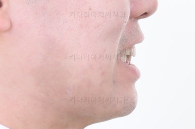 부산교정치과