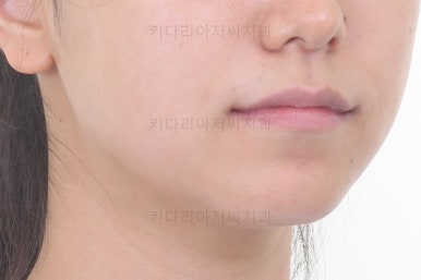 부산교정잘하는치과