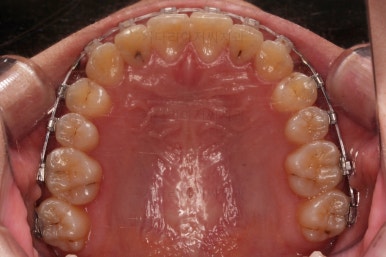 연산동교정치과