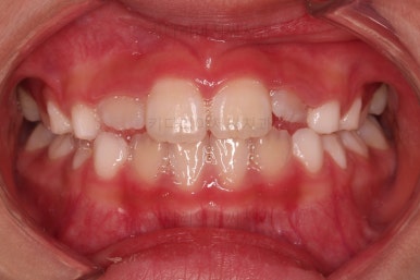 부산어린이교정