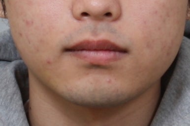 부산주걱턱교정