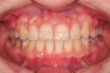 부산연산동교정치과