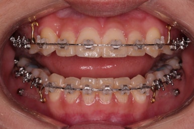 연산동교정치과