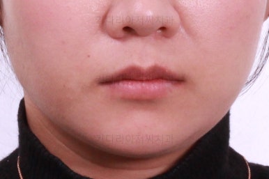 부산치아교정치과