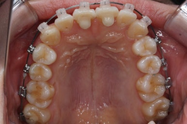 연산동교정치과