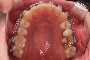 부산비대칭교정