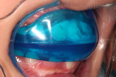 부산어린이교정