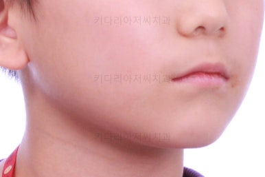 부산어린이교정