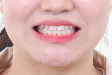 부산교정전문의