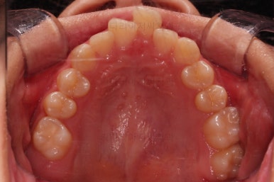 부산청소년교정치과