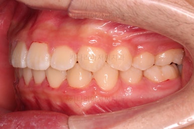 부산청소년교정