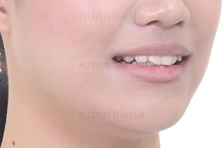 연산동치아교정치과