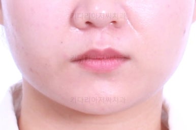 부산치아교정치과