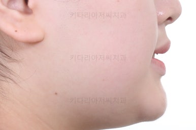 부산교정치과추천