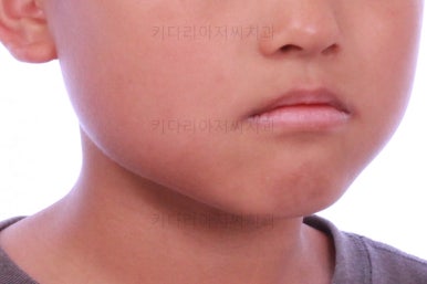 부산어린이교정