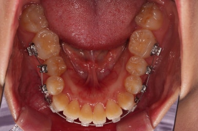 부산무턱교정치과