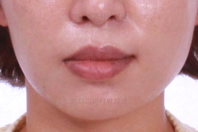 부산연산동교정치과