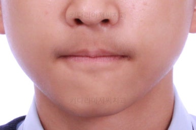 부산교정치과추천