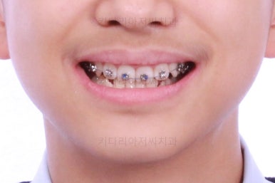 부산교정치과추천
