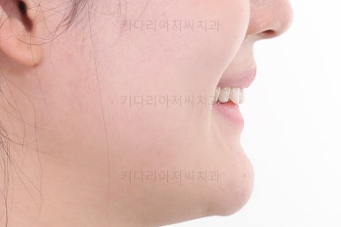 부산인비절라인