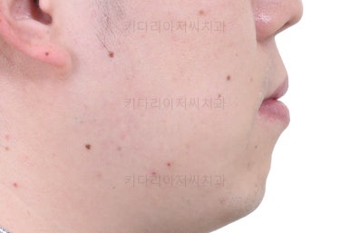 부산인비절라인