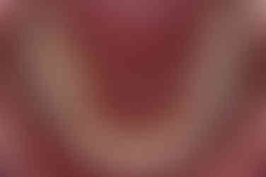 부산연산동교정치과