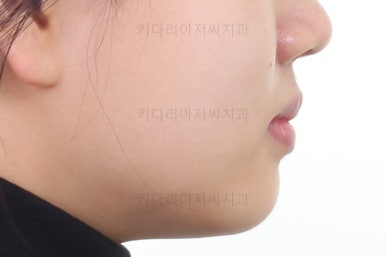 부산교정전문의