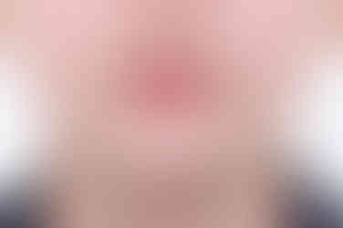 부산치아교정잘하는곳