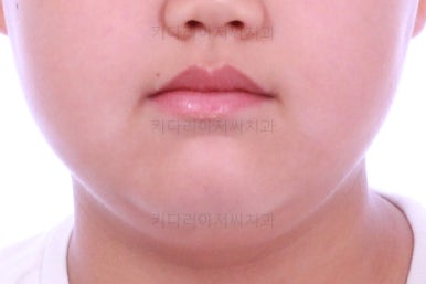 부산교정치과추천