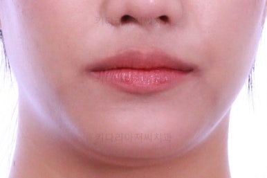 연산동치아교정치과