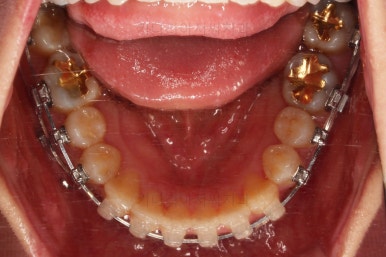 부산연산동치과