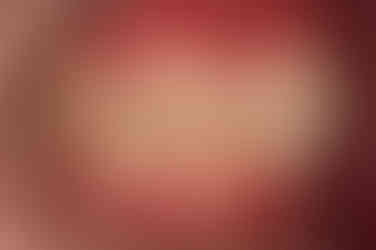 부산연산동사랑니발치