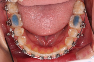 부산치아교정치과