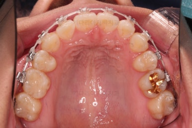 연산동치아교정치과