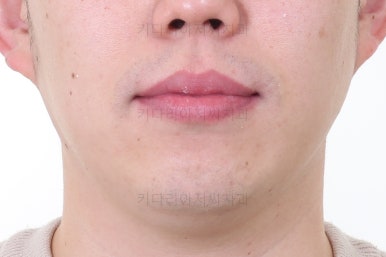 부산인비절라인