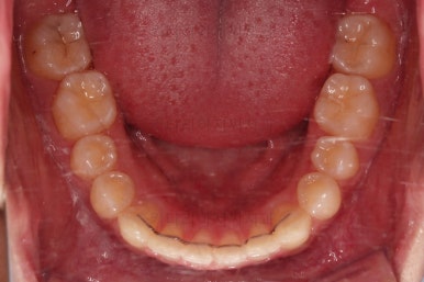 부산연산동치아교정