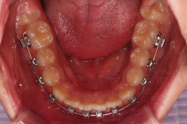 부산청소년교정