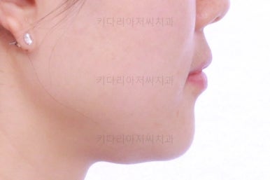 부산인비절라인