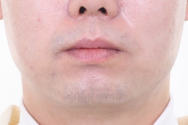 부산교정치과
