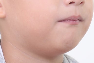 부산어린이치아교정