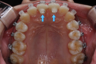 연산동교정치과